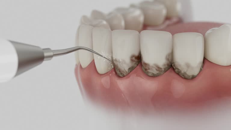 Trusted Tooth Extraction service in Nokesville, VA - Dentist Open Now